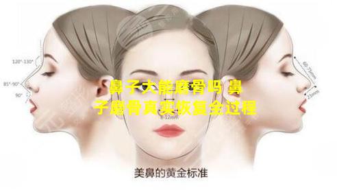 鼻子大能磨骨吗 鼻子磨骨真实恢复全过程